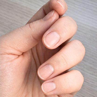 Naturnägel nach dem Entfernen von Dipping Powder, matt und ohne Produktreste